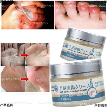 Ozebline Krema Anti-suhe, Razpokane Foot Cream Pete Krekirana Repair Krema Za Odstranjevanje Odmrle Kože, Nega nog in Razpokane Smetane, 50 g