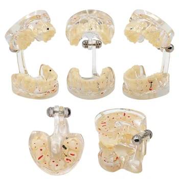 Zobni Otrok Mlečne Stalno Izmenično Model Fant Mlečnih Zob Stalnih Zob Študija Predstavitev Standarda Zobozdravnik Študent Model 5